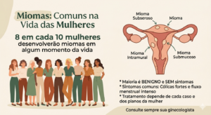 Miomas são mais comuns do que parecem
